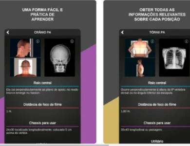 aplicativo RX – Posicionamento Radiográfico