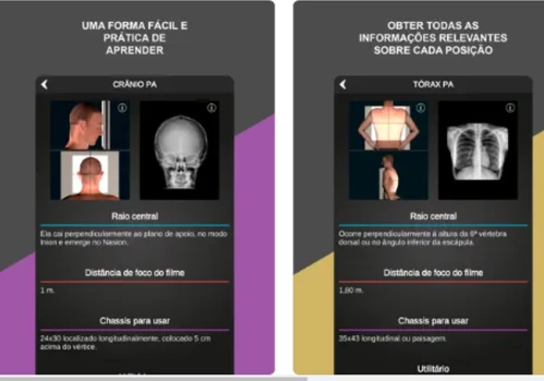 aplicativo RX – Posicionamento Radiográfico